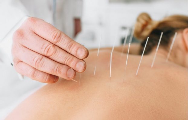 Corso ISICO sul dry-needling